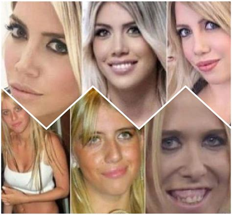 Wanda Nara irriconoscibile prima della chirurgia: spuntano le FOTO shock