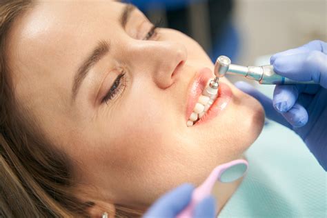 tipos de limpieza dental ofrecemos alpha clinica dental alpha