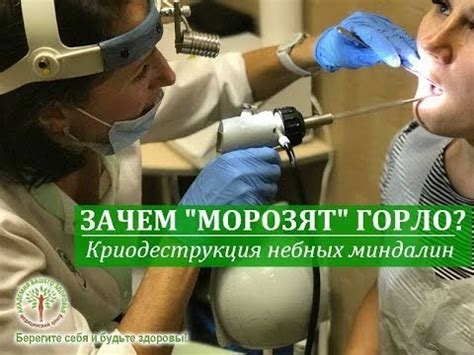 Криодеструкция (криолечение) миндалин в Киеве - YouTube