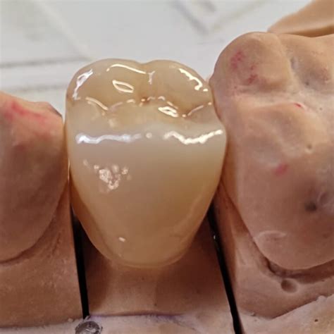 Zirconio Monolítico 2 - Laboratorio Dental Milla
