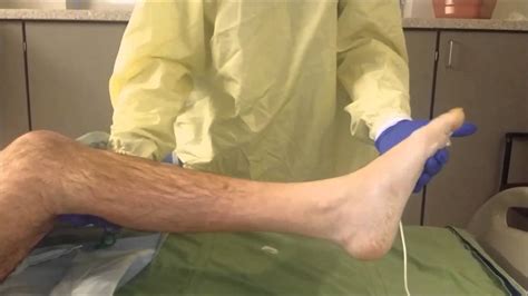 Ankle clonus - YouTube