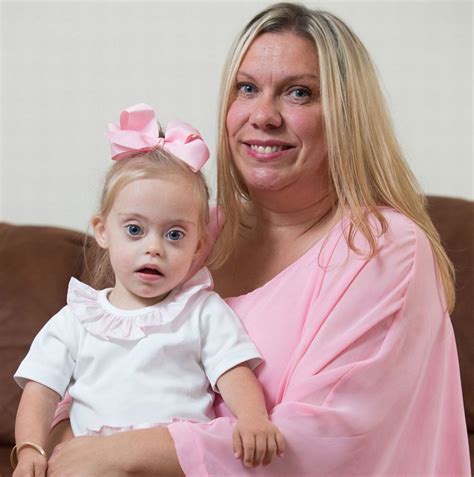 Two-year-old girl with Down syndrome became a model thanks to her ...