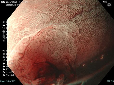 nbitxi clinical library case
