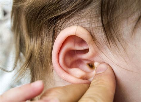 Ear Infections in Kids: Causes and Treatments