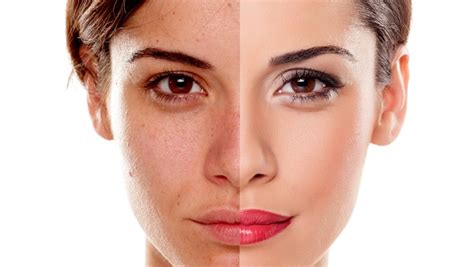 Make Your Dark Skin Fair | Beauty Tips and Totkay | Easy Tips & Totka