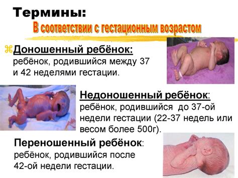 Новорожденный ребенок. Особенности периода новорожденности ...