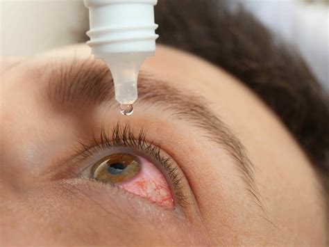 CUES Emergency Eye Care - Kings Opticians - Visionary Health Care