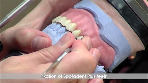 Альгинатная оттискная масса Elastic Cromo 450г (SpofaDental) - YouTube