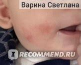 Дерматологическая мазь MSD Elocon %0,1 merhem momentazon furoat - «Если ...