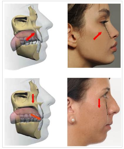The Different Causes Of A Receding Jawline | Justinboey