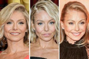 Kelly Ripa Before and After Plastic Surgery: Nose, Boob, Botox, Facelift