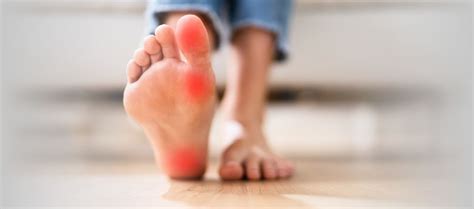 Complex Regional Pain Syndrome - Osteopedia - il portale mondiale dell ...