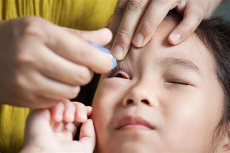 obat tetes mata anak  aman  atasi mata merah  sehat