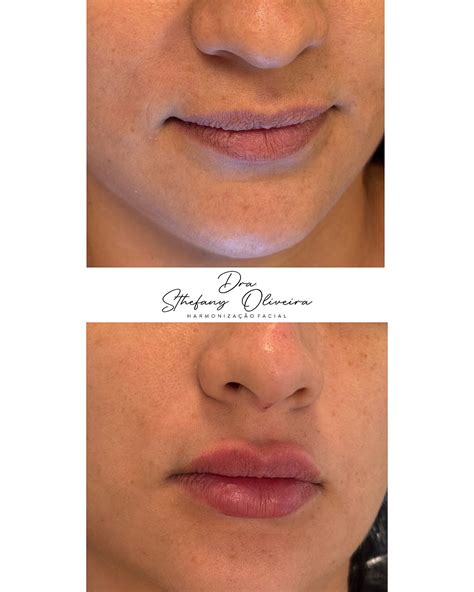 Sthefany Oliveira (@drasthefanyoliveira) • Instagram photos and videos