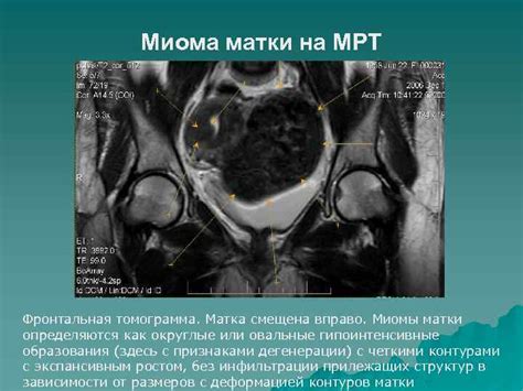 Сеть диагностических центров МРТ ЭКСПЕРТ Сравнительная характеристика УЗИ