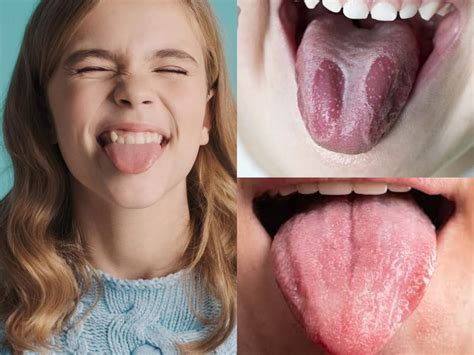 perbedaan warna lidah normal  tidak normal  wajib kalian ketahui