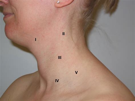 What do swollen supraclavicular lymph nodes indicate - broadasse
