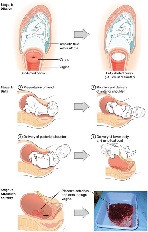 Birth Dilation