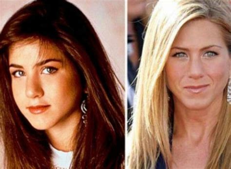 Hottest Women Celebrity: Before & After Photos SHOCK the World! - d6jzbze