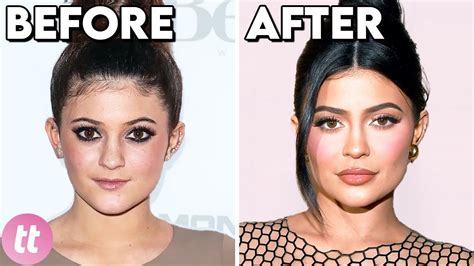 Before And After Celebrities Without Makeup | Saubhaya Makeup