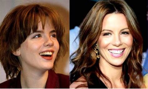 Kate Beckinsale Plastic Surgery - An Amazing Cosmetic Procedure