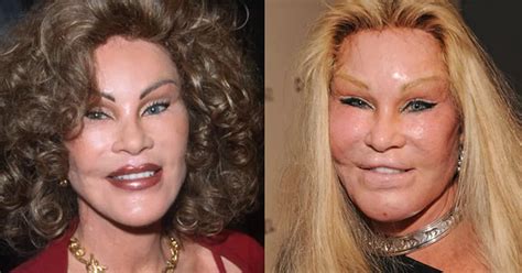 Celebrity plastic surgery - Daily Record
