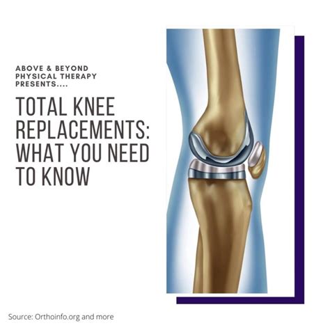 Total Knee Replacement Rehab Fact Sheet Series - Above & Beyond ...