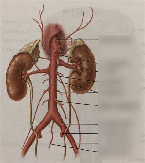 lower abdominal and iliac arteries 1 Diagram | Quizlet