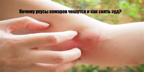 Почему чешется укус комара и как снять зуд — Центр дезинфекции Герадез