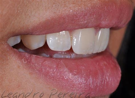 11 21 (Leandro Pereira). | Convenience store products, Dental ...