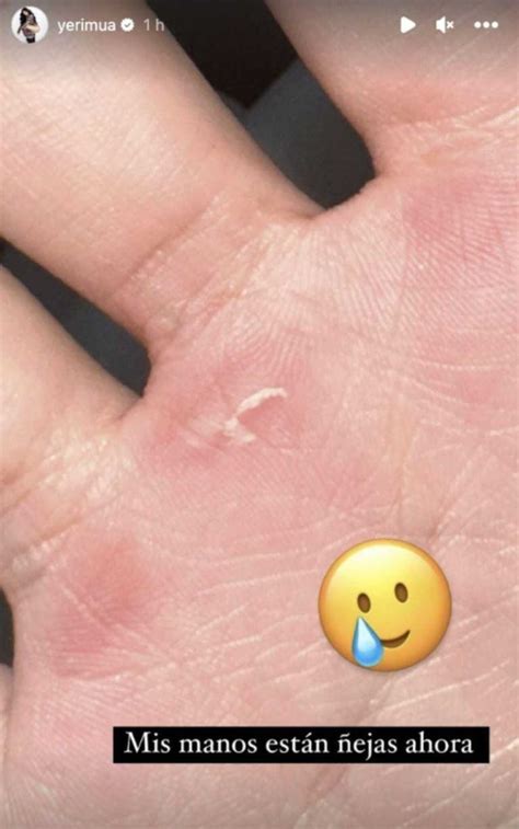 ¿Naim la golpea?: Yeri Mua aparece con moretones en el cuerpo y