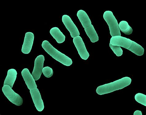 Lactobacillus Sp Como Se Pega - Lactobacillus Sp Como Se Pega - BRAINCP