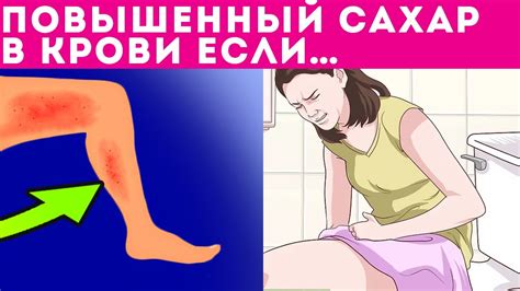 СРОЧНО! 10 неявных признаков повышенного сахара крови (диабет) - YouTube