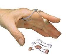 Capener Finger Splint at Best Price in Nadia - ID: 2997572 | FRA Orthosis