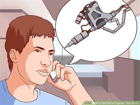 3 Ways to Get Rid of Ingrown Hair Scars - wikiHow