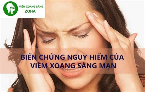 tong hop kien thuc ve benh viem xoang ham man instagram dieu chua