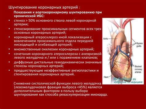 ИБС: стабильная стенокардия - презентация онлайн