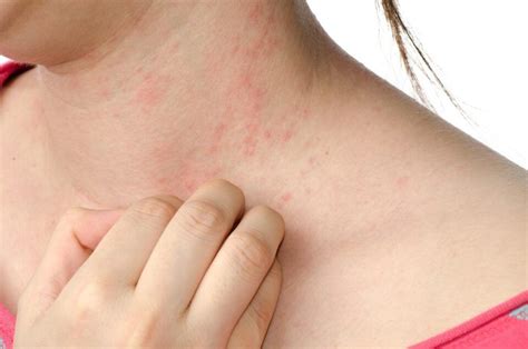 Bolinhas E Coceira No Corpo