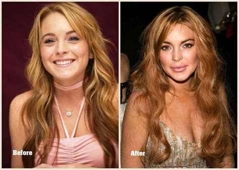 Forum Phun Celebrity Extra: Before & After Photos That Will SHOCK You Image 2