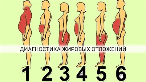 О чем говорят жировые отложения на разных частях тела?