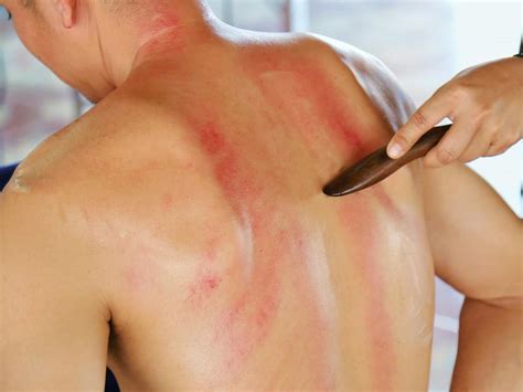 Symptoms of Chromhidrosis: Hines Dermatology Associates Inc.: Dermatology
