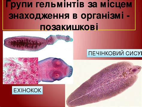 Паразитичні безхребетні тварини
