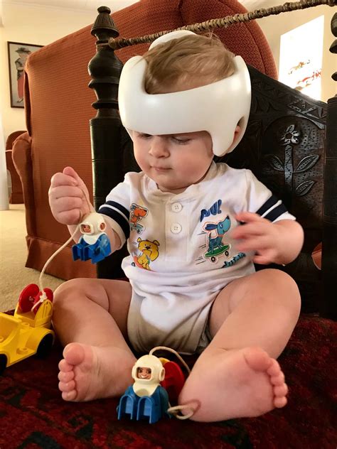 Cranial Helmet FAQ's Answered By A Mom