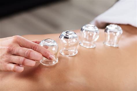 Cupping 101: Everything You Need to Know About This Treatment - Aaptiv