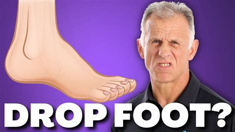 10 exercises for foot drop after stroke nerve or muscle damage weak ankle foot – Artofit