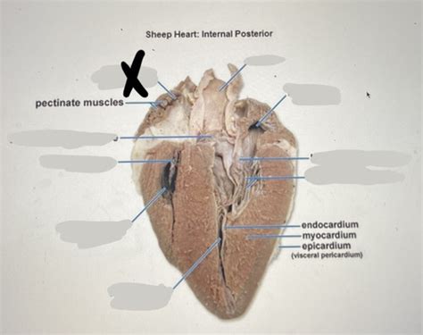 exercise 16: gross anatomy of the heart (sheep heart) Flashcards | Quizlet