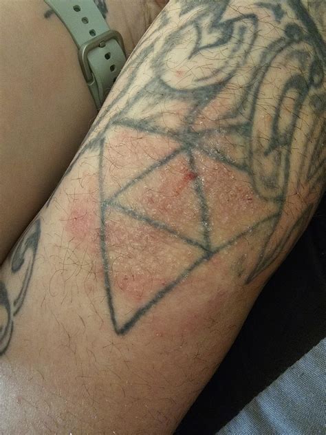 What could these rashes be? He always gets them. : r/skin