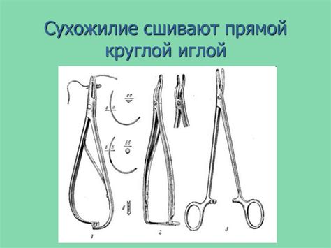 Швы сухожилий - презентация онлайн