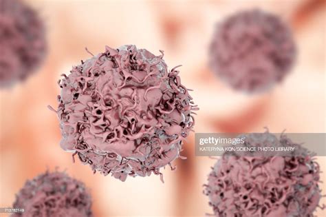 Lung Cancer Cell Illustration High-Res Vector Graphic - Getty Images