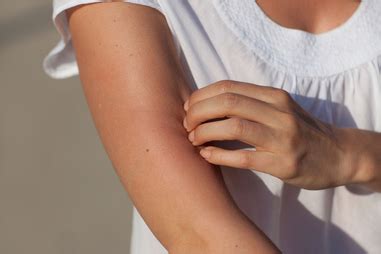 Itchy skin - treatments, causes and prevention | healthdirect